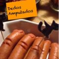Dedos amputados
