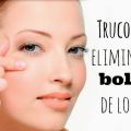 Remedios Contra las Bolsas de los Ojos